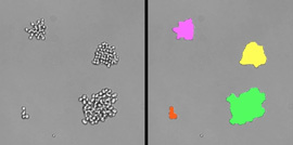 image of yeast microcolonies