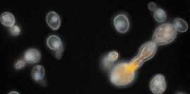 image of yeast cells